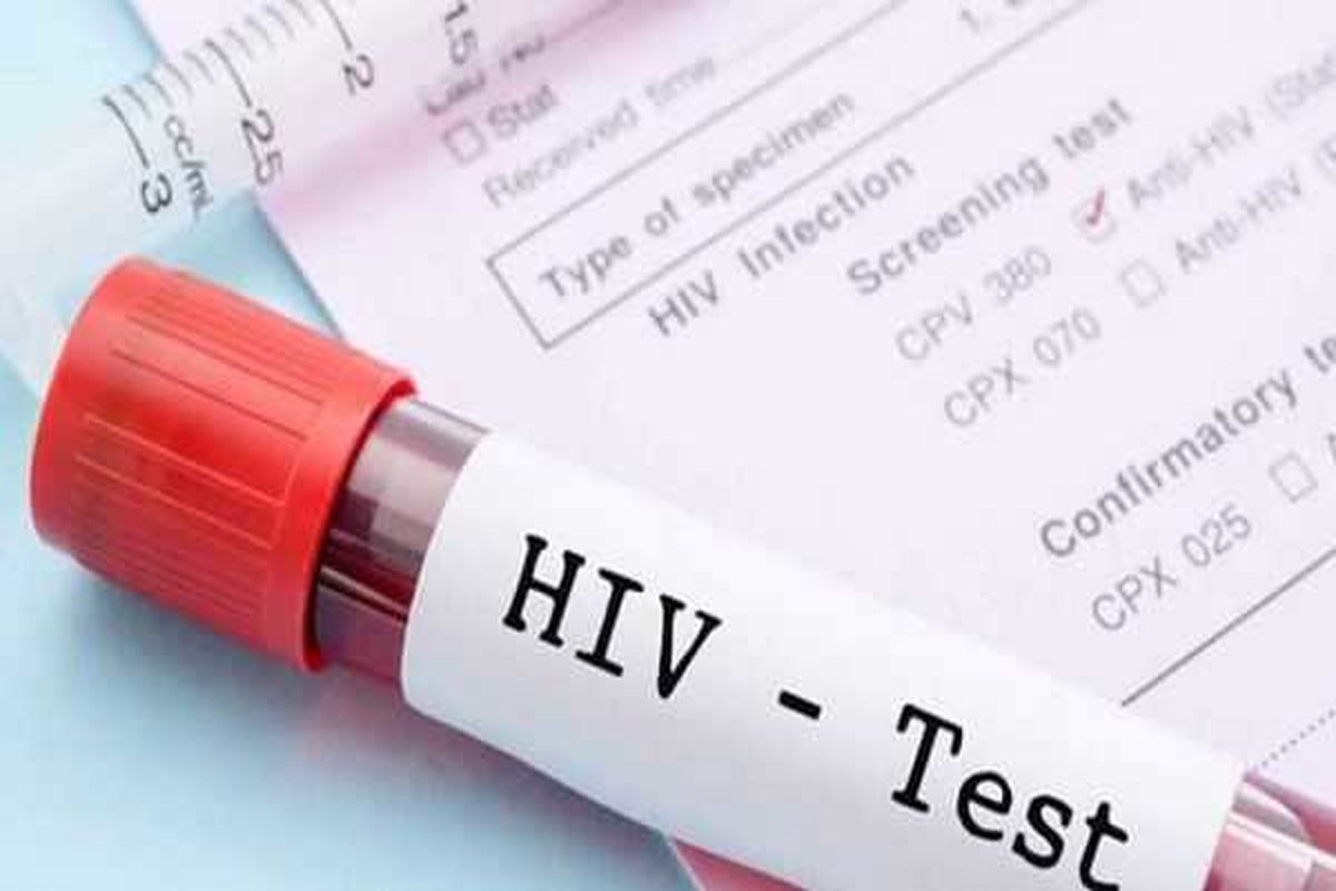 غربالگری رایگان ویروس اچ ای وی در مراکز جامع خدمات سلامت