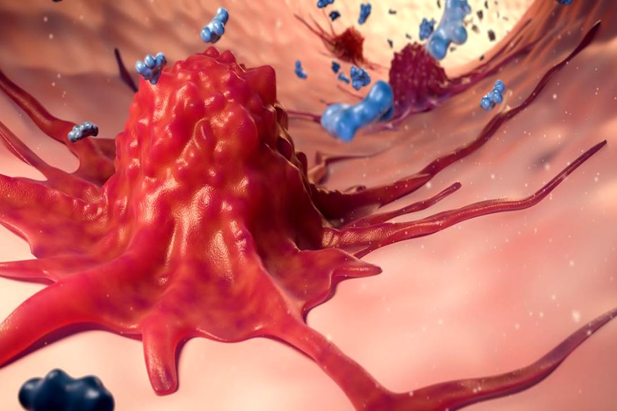 ساخت استنت‌های خودگرم‌شونده برای مقابله با تومور سرطانی