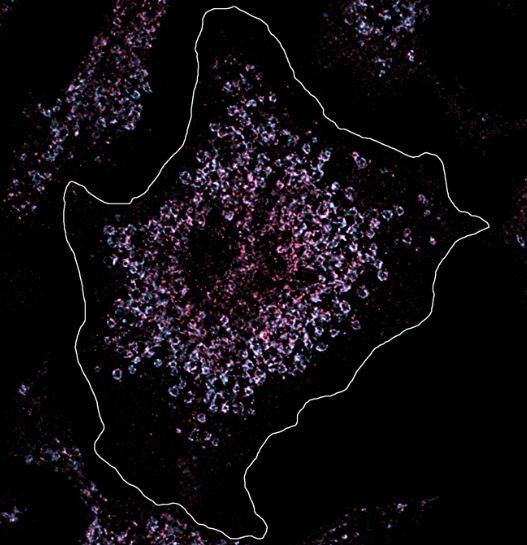 محرک بیماری لوپوس کشف شد!