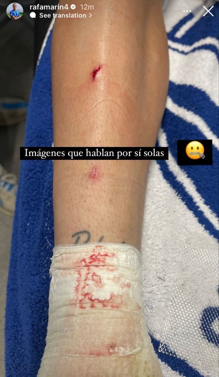 تتو یا زخم؟ کارت قرمز جنجالی جو لالیگا را به هم ریخت + عکس تتو یا زخم؟ کارت قرمز جنجالی جو لالیگا را به هم ریخت + عکس