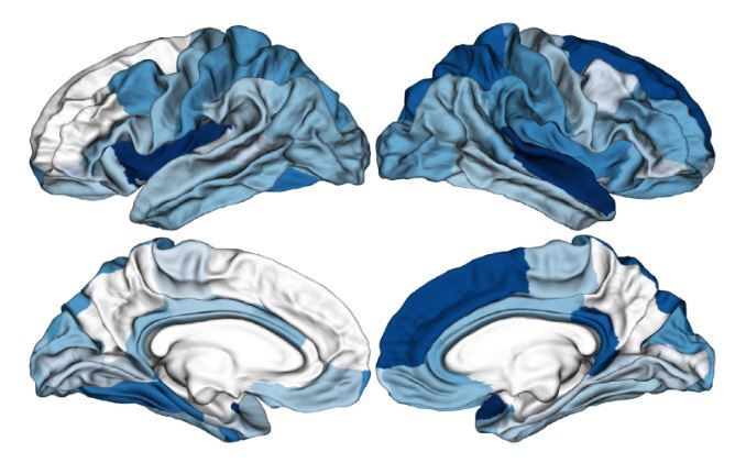 پیش بینی روان پریشی قبل از وقوع پیش بینی روان پریشی قبل از وقوع
