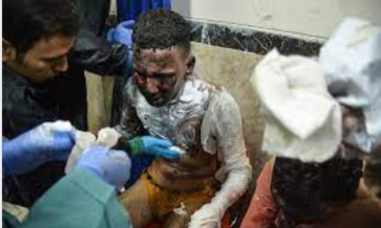 مصدومان چهارشنبه سوری در قزوین به ۱۲۵ نفر افزایش یافت مصدومان چهارشنبه سوری در قزوین به ۱۲۵ نفر افزایش یافت