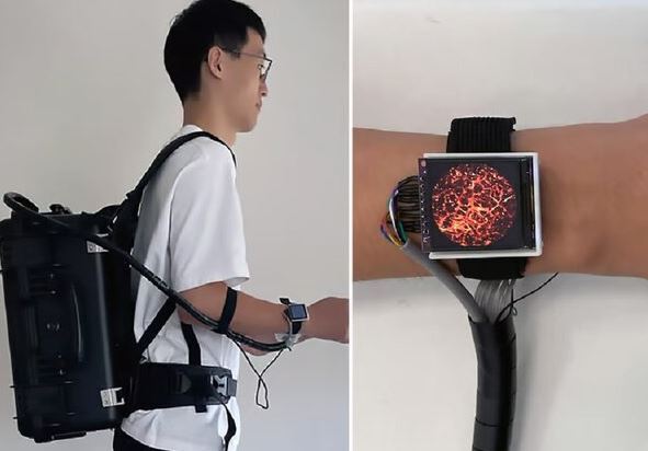 ساخت یک ساعت جدید برای دیدن داخل بدن ساخت یک ساعت جدید برای دیدن داخل بدن