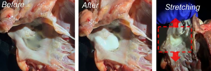 تکنولوژی جدید سونوگرافی می تواند برای ایمپلنت های سه بعدی در داخل بدن استفاده شود