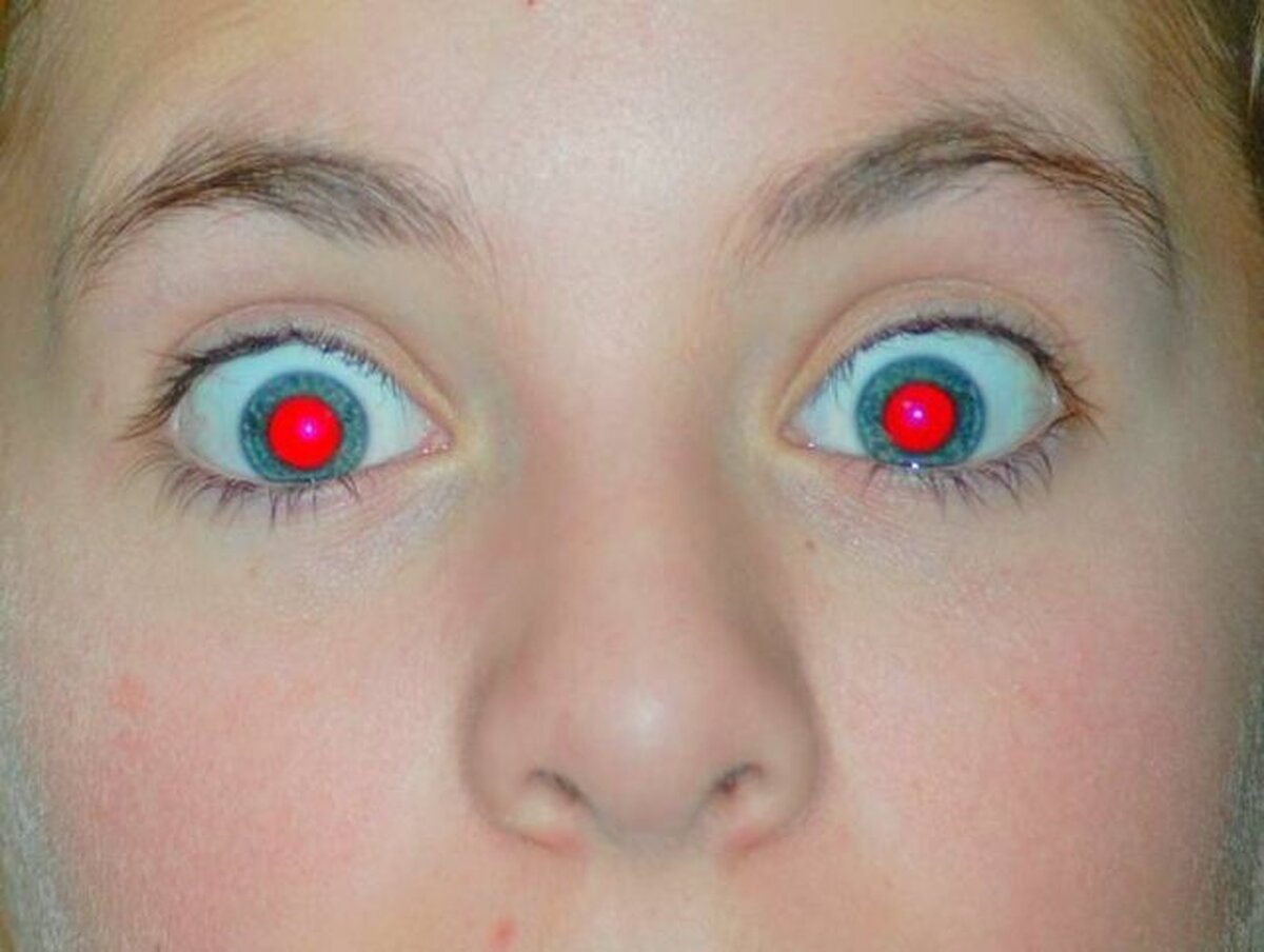 آیا قرمز شدن مردمک چشم در عکس‌ها نشانه بیماری است؟