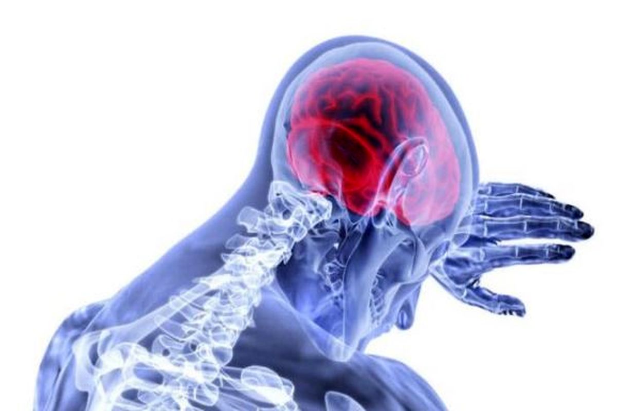 توسعه الگویی جدید برای درک صدمات مغزی