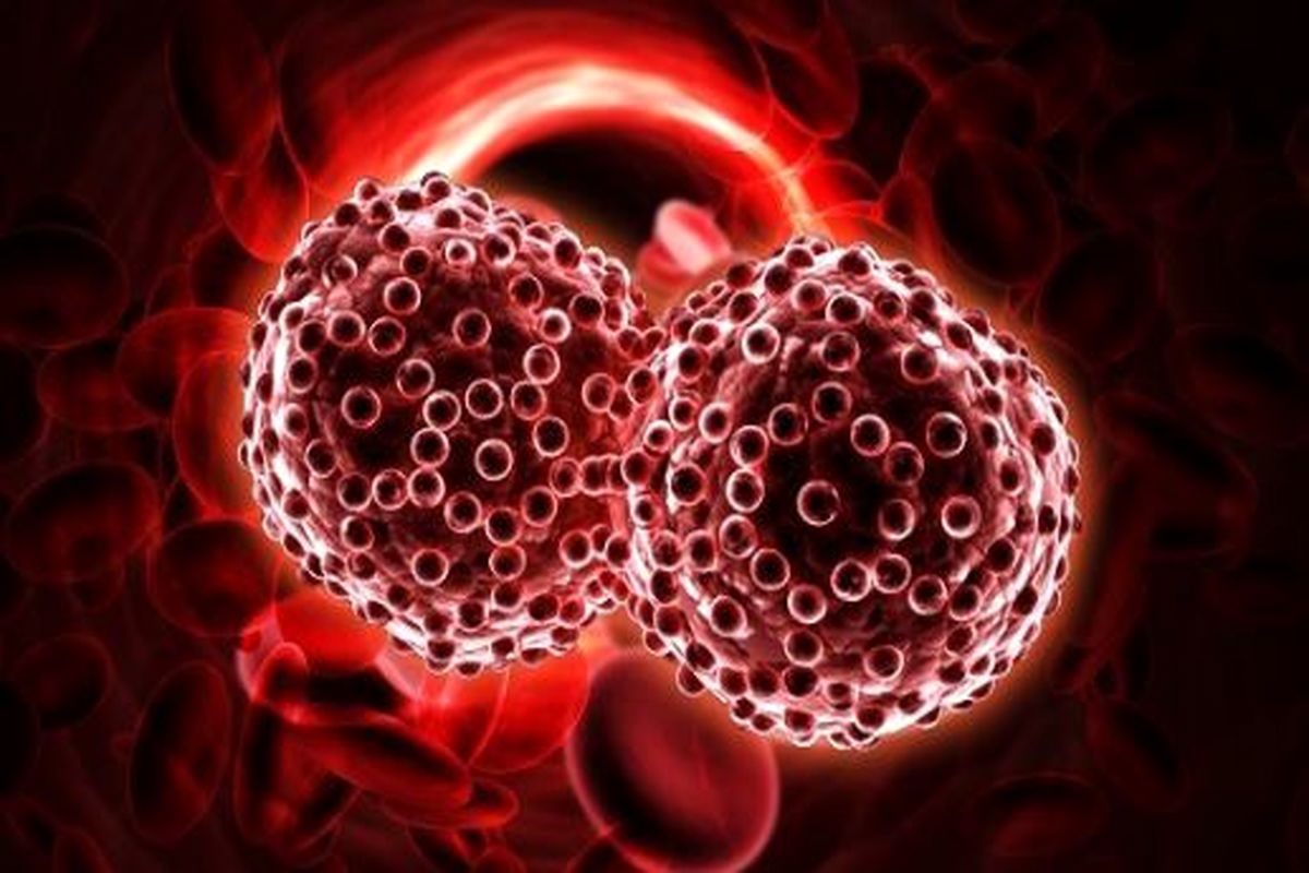 راهبردهای برای درمان موثر سرطان خون