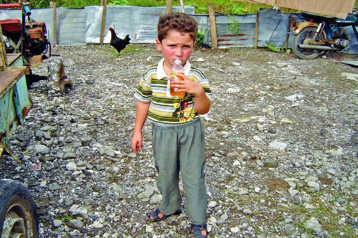این پسر بچه ایرانی هر روز نیم لیتر بنزین می‌خورد! + تصاویر