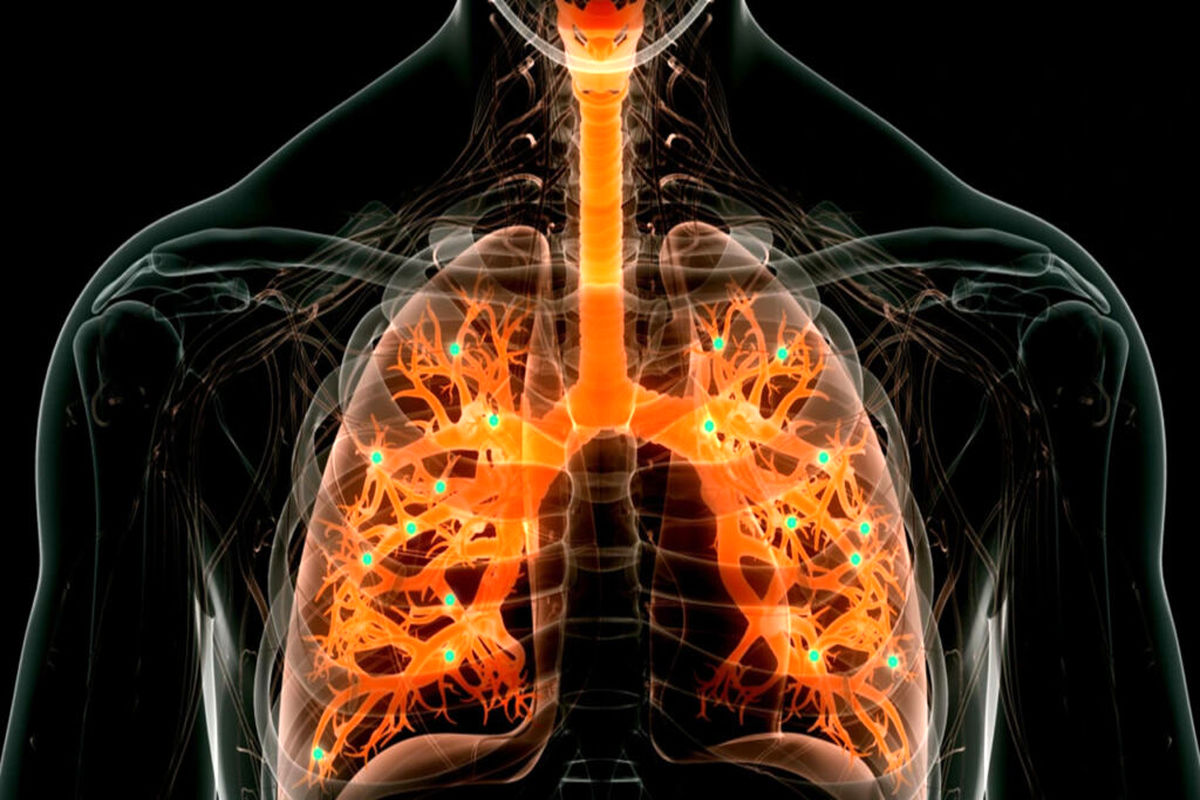 نانوفناوران راهکار جدیدی برای درمان بیماری‌های ریه پیدا کردند