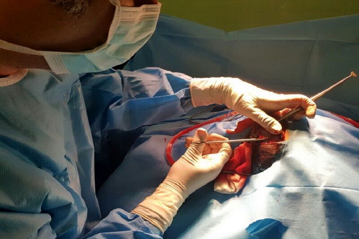 جراحی مغز در بیداری در بیمارستان  شهدای تجریش