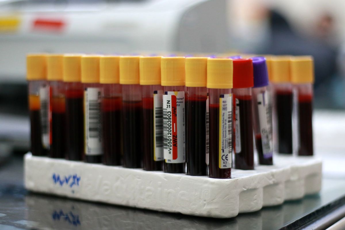 تلاش برای ثبت ۲ میلیون داوطلب اهداکننده سلول های بنیادی خونساز