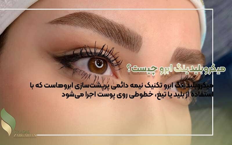 فیبروز ابرو و میکروبلیدینگ از تکنیک های هاشور ابرو فیبروز ابرو و میکروبلیدینگ از تکنیک های هاشور ابرو