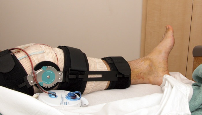 جراحی رباط صلیبی قدامی و بازسازی آن