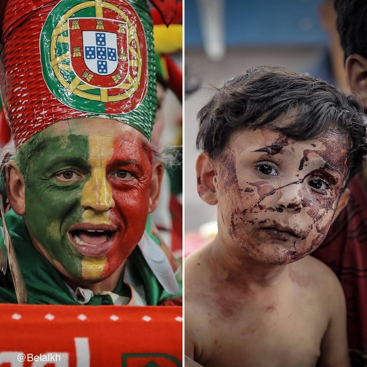 روایتی غم‌انگیز از شادی جام جهانی تا غم غزه +  تصاویر