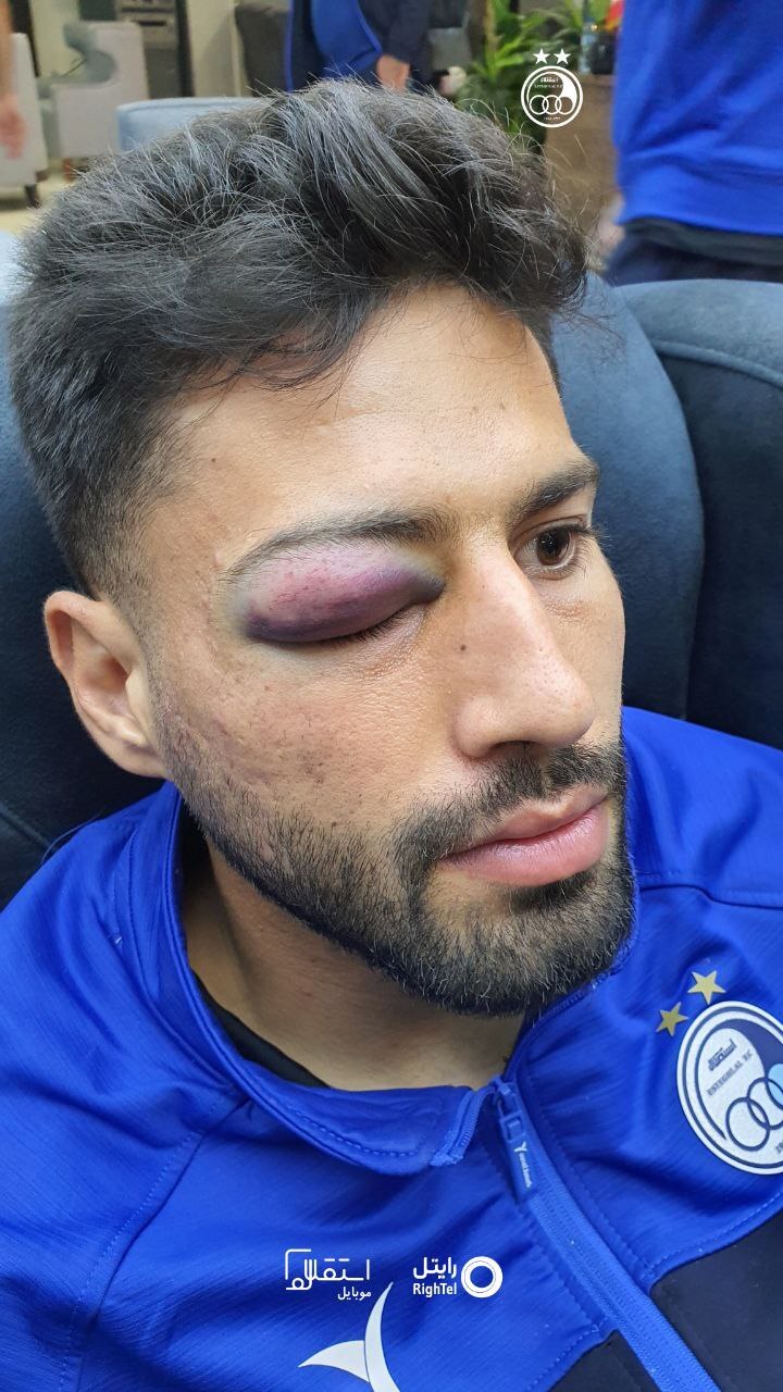 تصویر عجیب باشگاه استقلال از مدافع خود/ خطر از بیخ گوش سلیمی گذشت +عکس