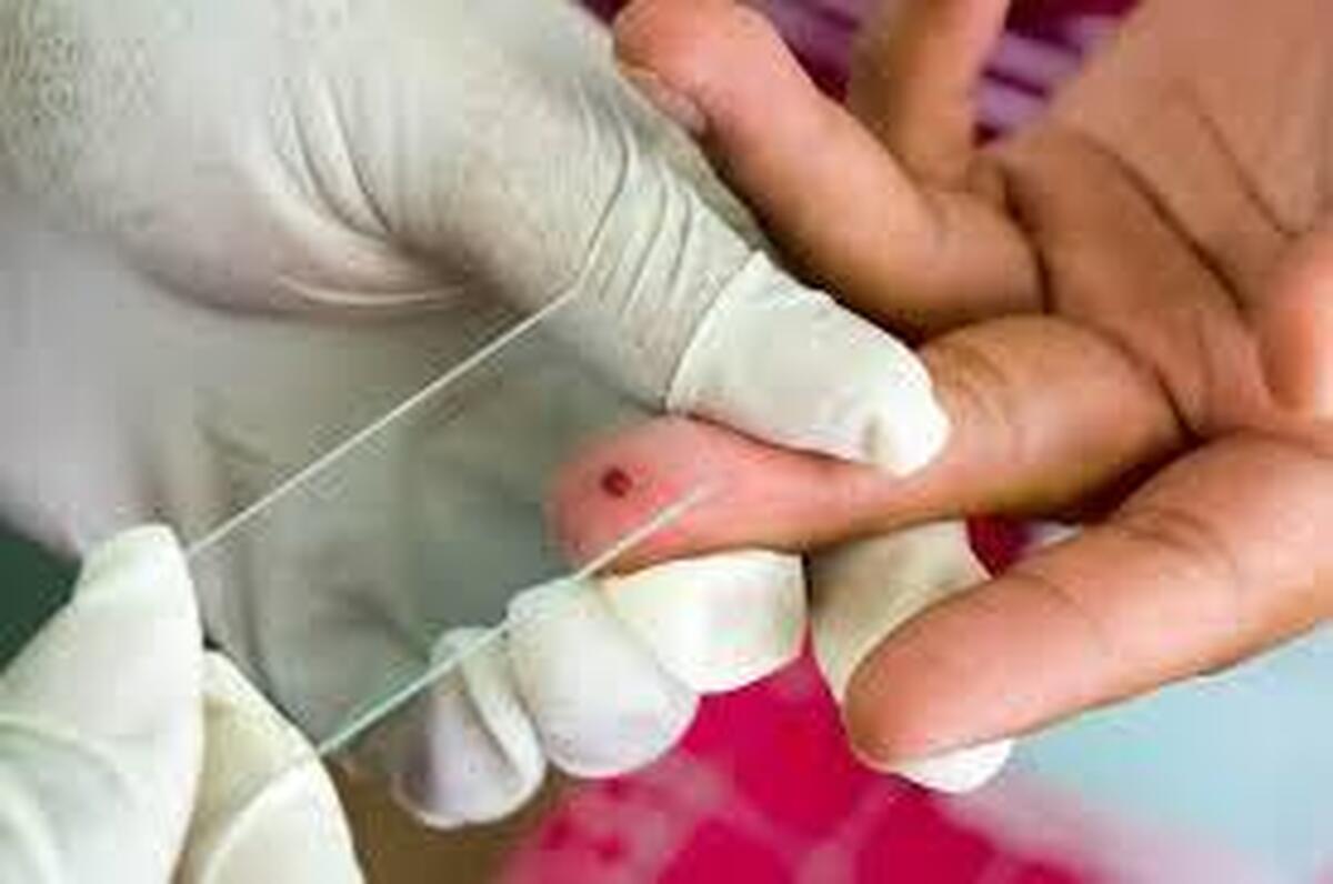 انجام بیش از  هزار مورد تست مالاریا در ایام نوروز