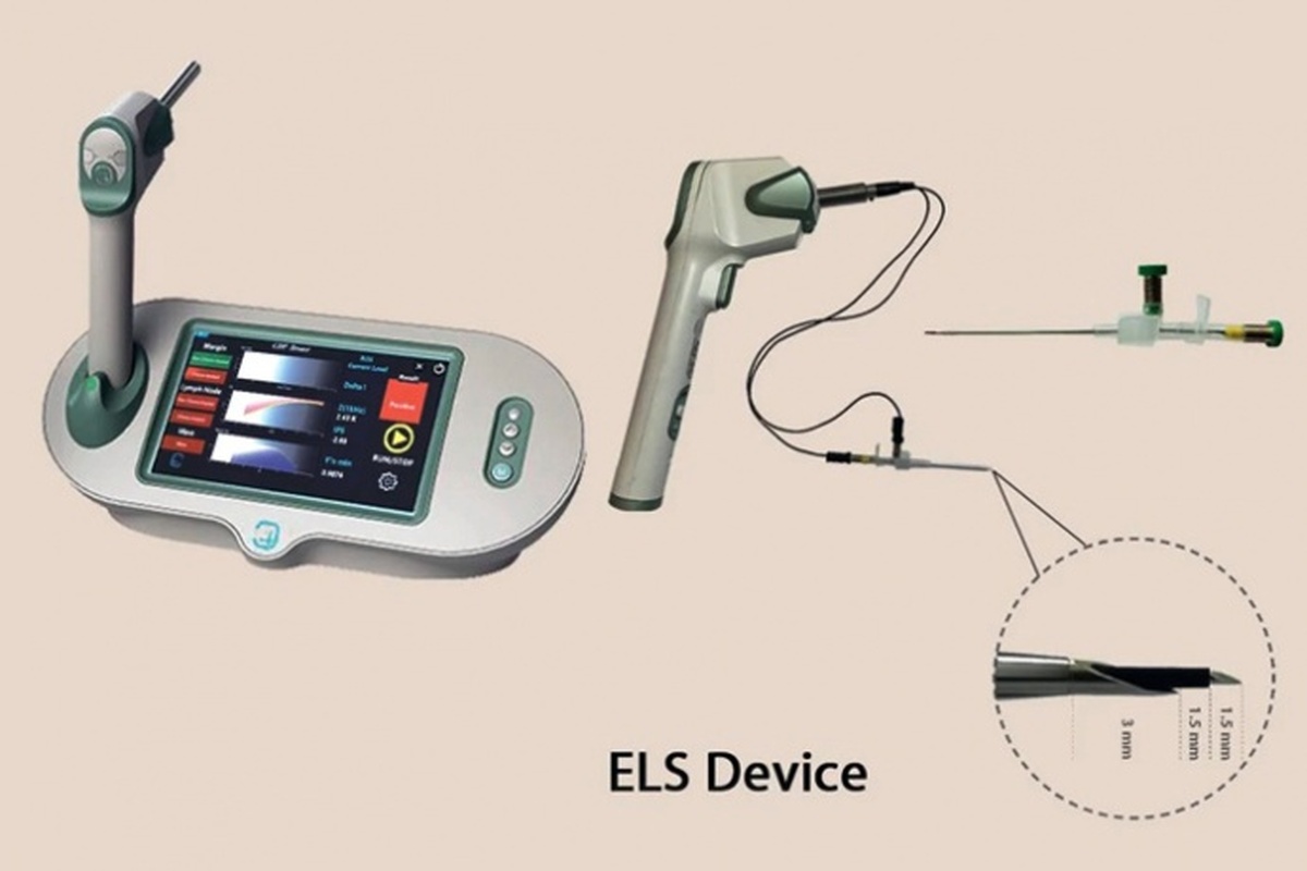 سیستم الکتریکی تشخیص غدد لنفاوی سرطانی ساخته شد