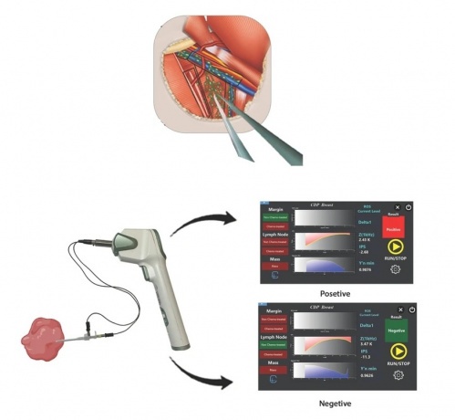 سیستم الکتریکی تشخیص غدد لنفاوی سرطانی ساخته شد