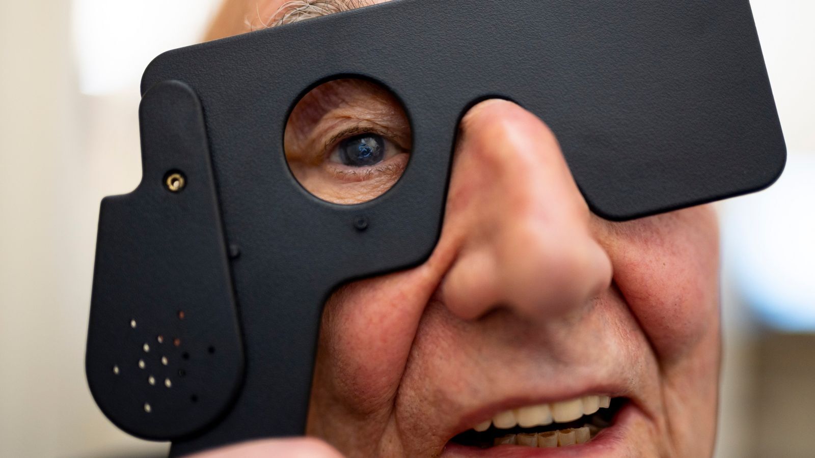 اولین پیوند قرنیه مصنوعی جهان با موفقیت انجام شد اولین پیوند قرنیه مصنوعی جهان با موفقیت انجام شد