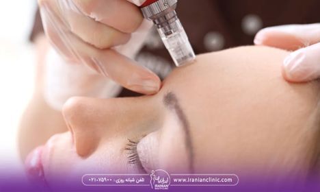 فرق مزوژل و مزوتراپی چیست؟ فرق مزوژل و مزوتراپی چیست؟