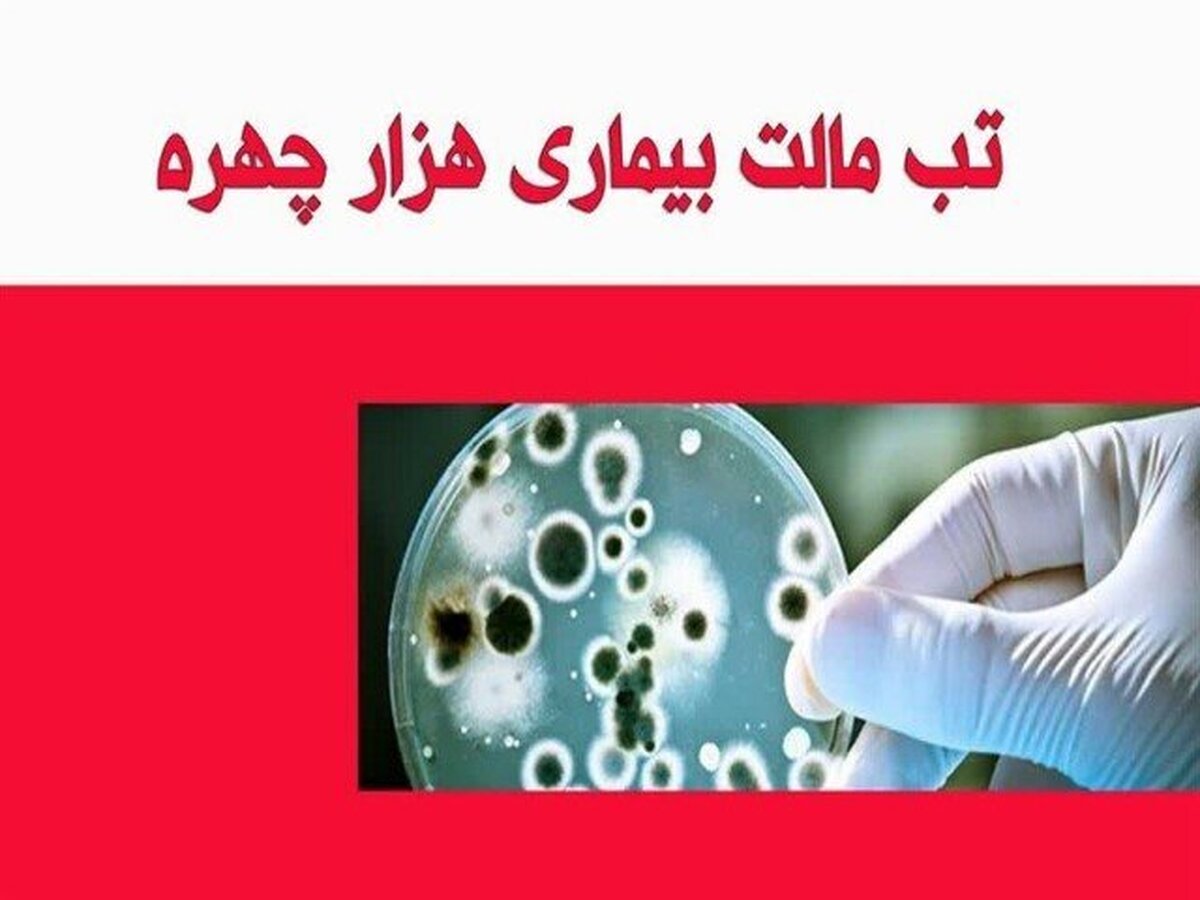 ۷۰ درصد مبتلایان تب مالت کردستان مربوط به مناطق روستایی است