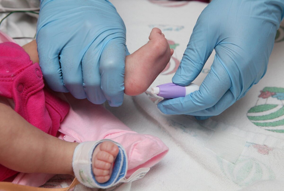 شناسایی سالانه بیش از ۷۵ نوزاد مبتلا به اختلالات تیروئید در خراسان جنوبی