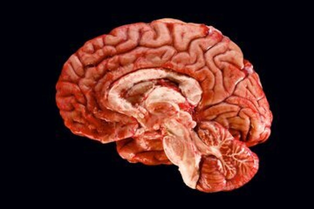 ثبت تصویر مغز انسان با وضوح بی‌سابقه+عکس