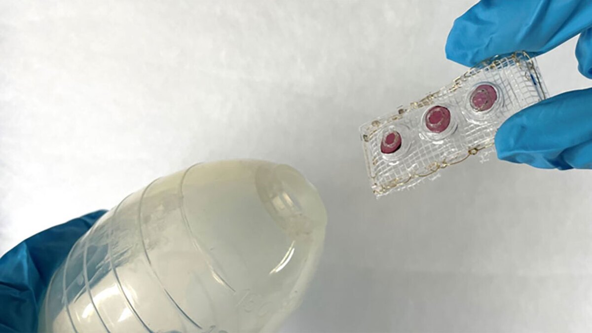 تشخیص نشت مایعات در سیستم گوارش بعد از عمل