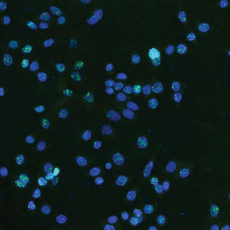 با زباله DNA سرطان را درمان کنید