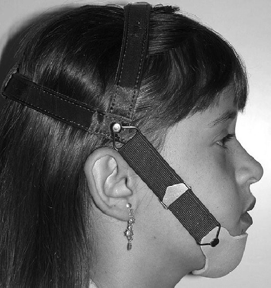 بهترین روش برای درمان آندربایت