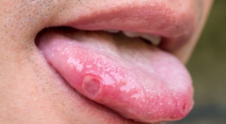 پاسخ علم به شایعه جدید درباره ایمپلنت پاسخ علم به شایعه جدید درباره ایمپلنت