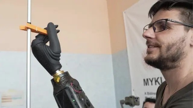 اولین دست مصنوعی که با فکر حرکت می‌کند