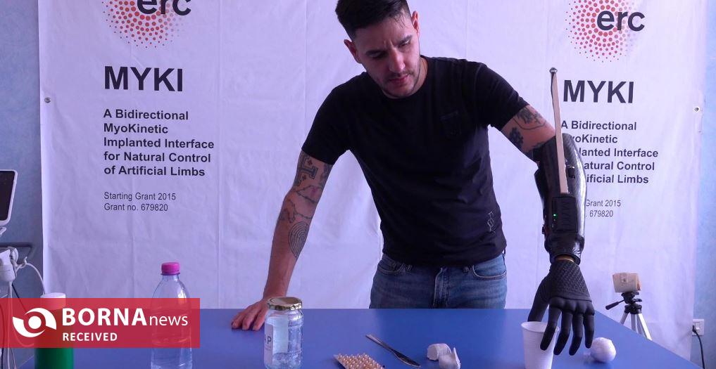 اختراع دست مصنوعی مغناطیسی/ انقلابی در کنترل حرکات برای قطع عضوها