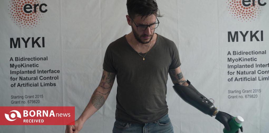 اختراع دست مصنوعی مغناطیسی/ انقلابی در کنترل حرکات برای قطع عضوها