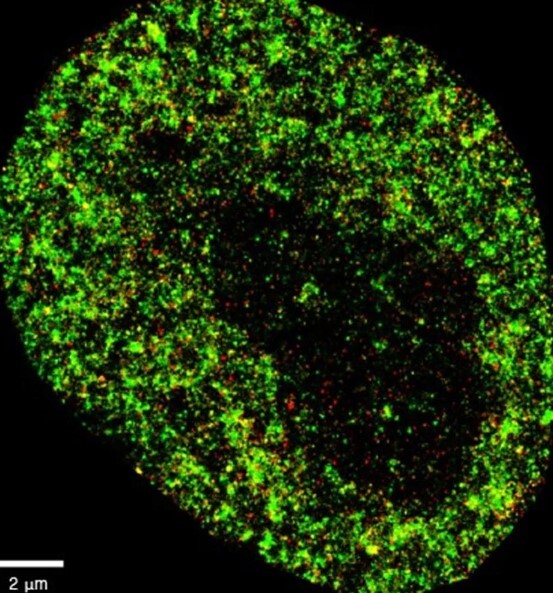 تشخیص نانویی سرطان با هوش مصنوعی AINU