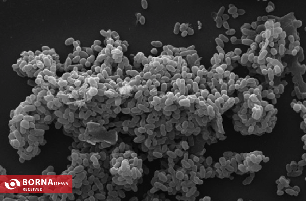 کشف ارتباط روده و اوتیسم در نوزادان کشف ارتباط روده و اوتیسم در نوزادان