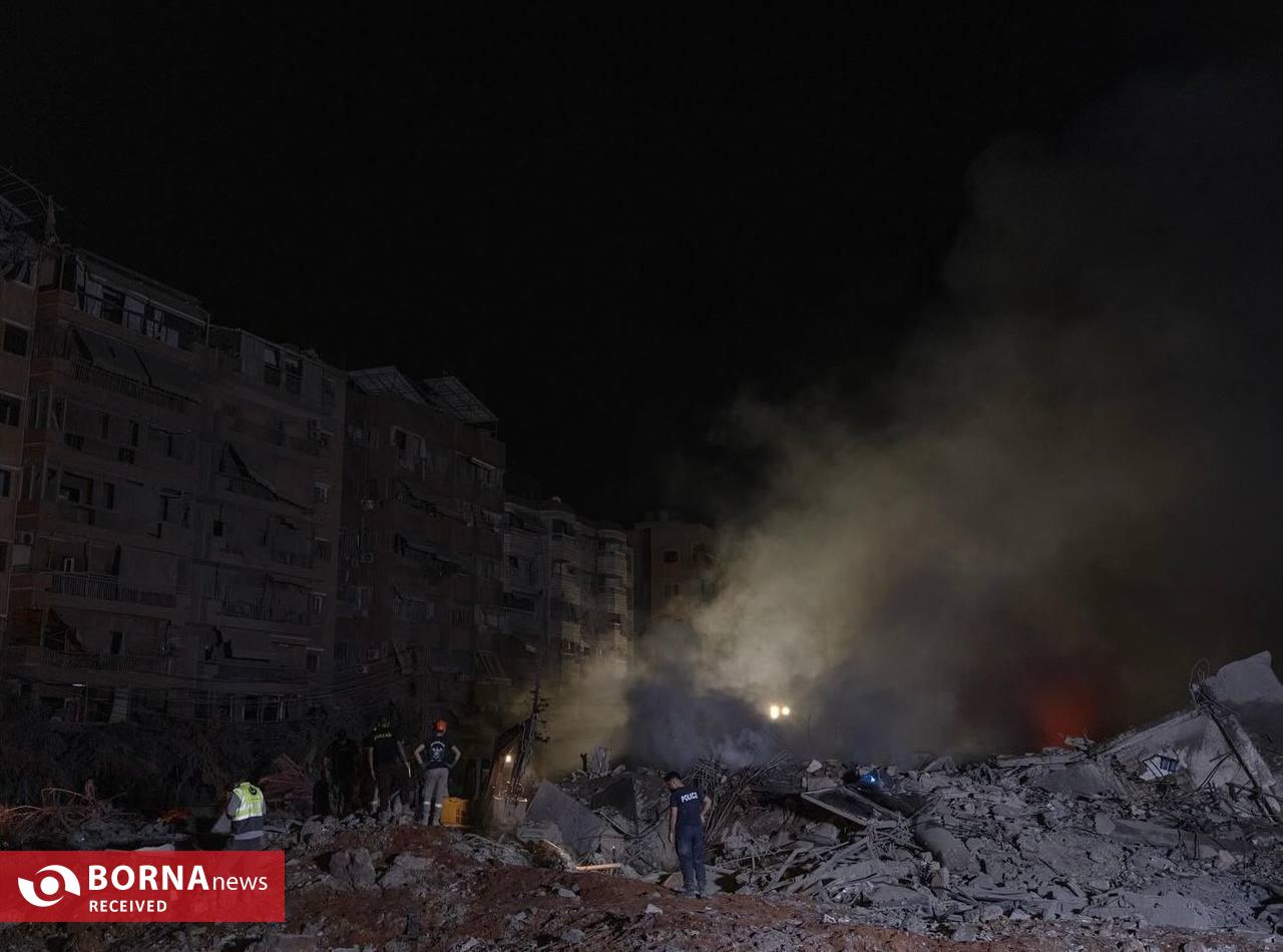 علی خارا از شرایط جنگ می‌گوید/ بار‌ها تا نزدیکی مرگ رفته‌ام