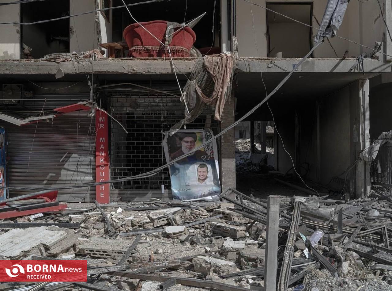 علی خارا از شرایط جنگ می‌گوید/ بار‌ها تا نزدیکی مرگ رفته‌ام