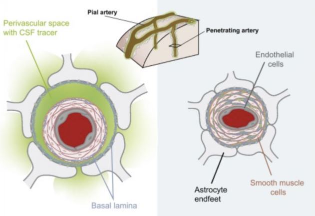 نقشهبرداری از سیستم دفع مواد زائد مغز انسان برای اولین بار نقشهبرداری از سیستم دفع مواد زائد مغز انسان برای اولین بار