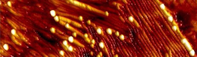 راز گسترش آلزایمر فاش شد!