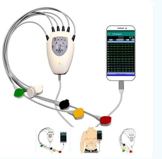 موتورلانس های تهران کلینیک های سیار قلبی شدند