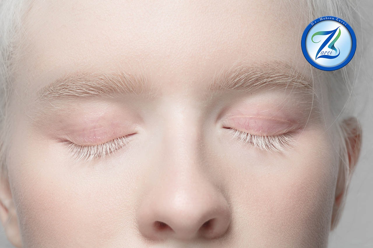 انواع بینی فانتزی در سال 2024 انواع بینی فانتزی در سال 2024