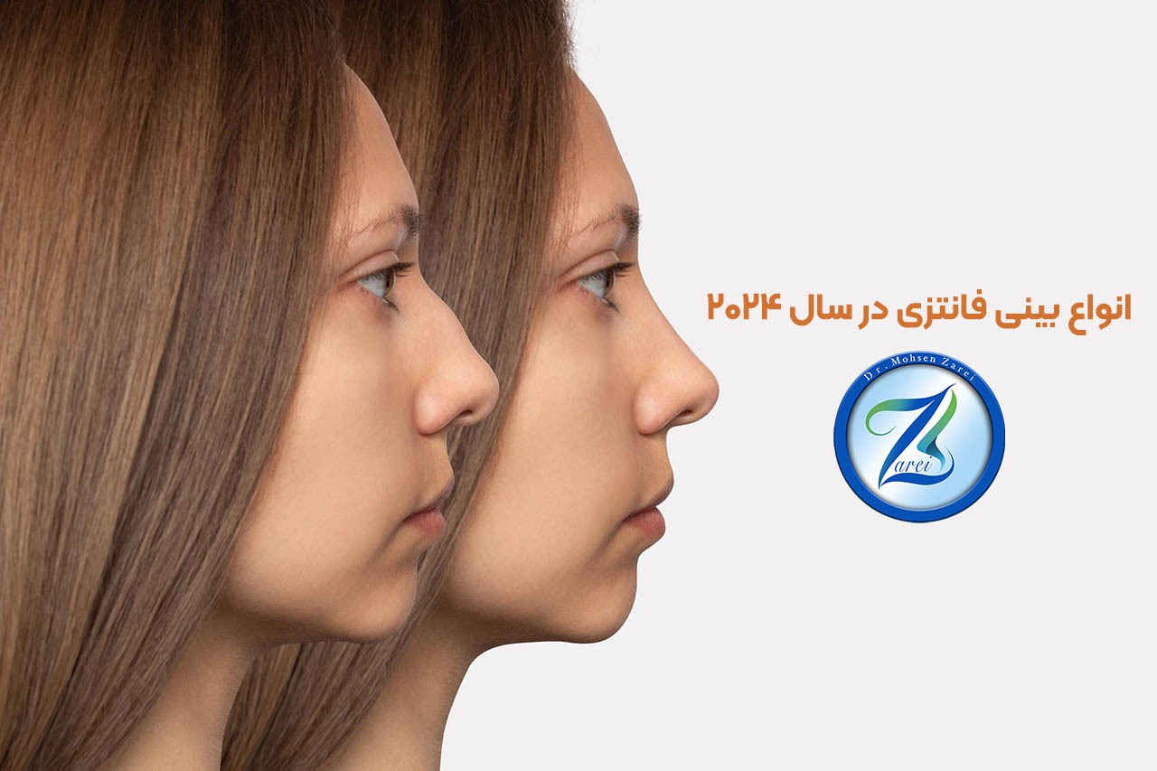 انواع بینی فانتزی در سال 2024 انواع بینی فانتزی در سال 2024