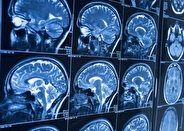 تحولی در علوم اعصاب؛ ثبت لحظه‌ای امواج مغزی و کلید رمزگشایی از فعالیت‌های پنهان مغز  با EEG