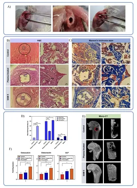 ارتقای رشد استخوان با داربستهای زیستی پوششدار ارتقای رشد استخوان با داربستهای زیستی پوششدار