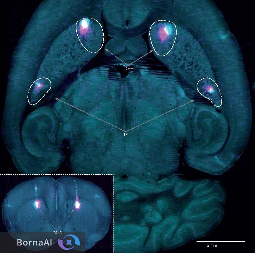 مغز راز عادت‌ها را لو داد/ کشف سیستم پنهان یادگیری در انسان