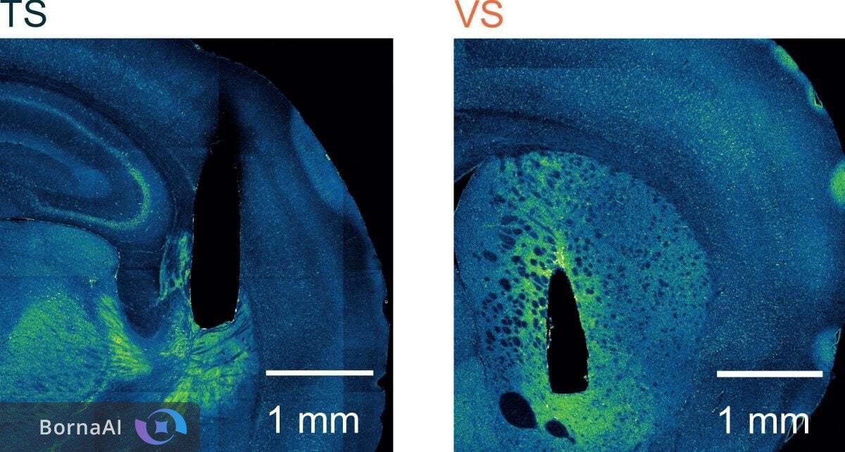 مغز راز عادت‌ها را لو داد/ کشف سیستم پنهان یادگیری در انسان