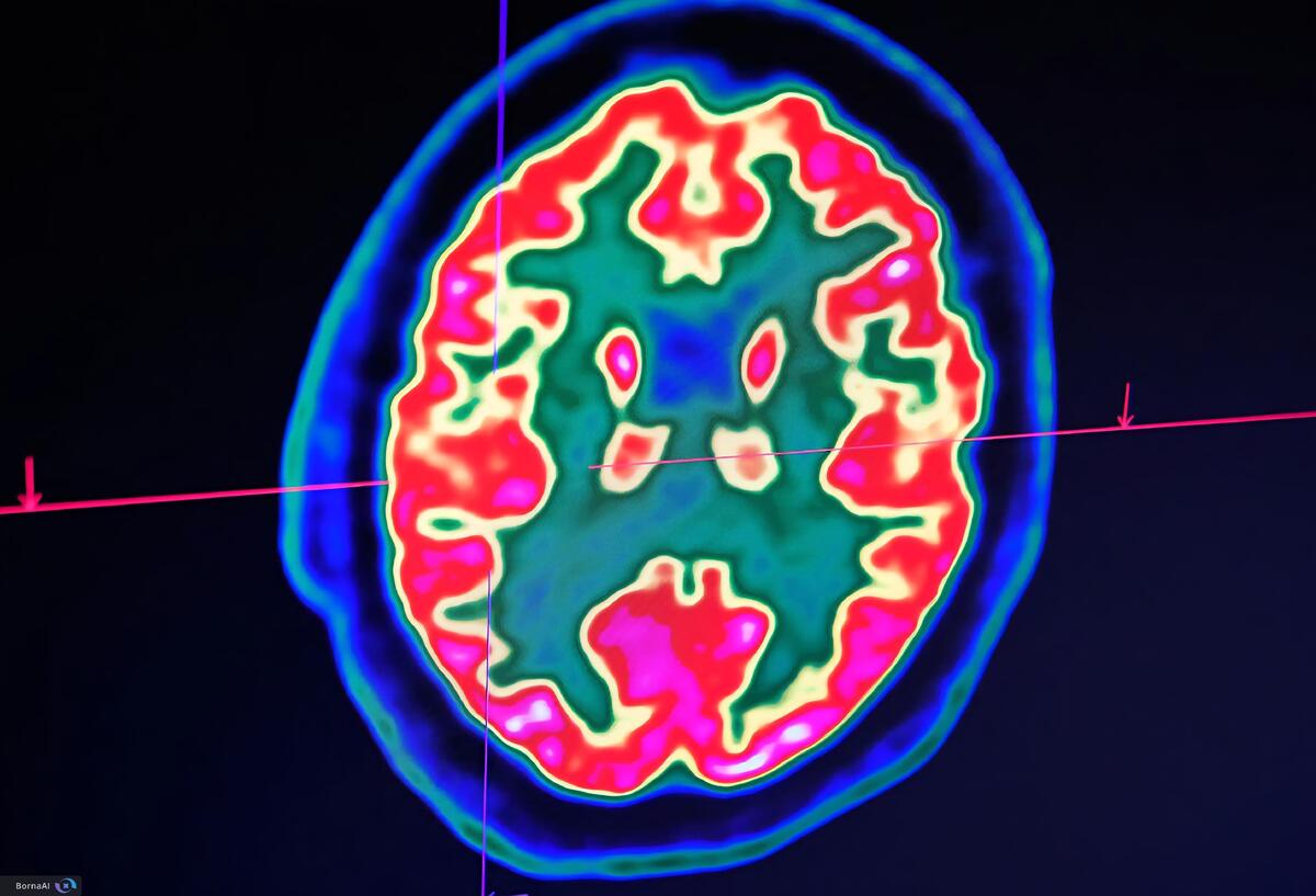 شباهت‌های عملکردی میان مغز انسان و هوش مصنوعی کشف شد!