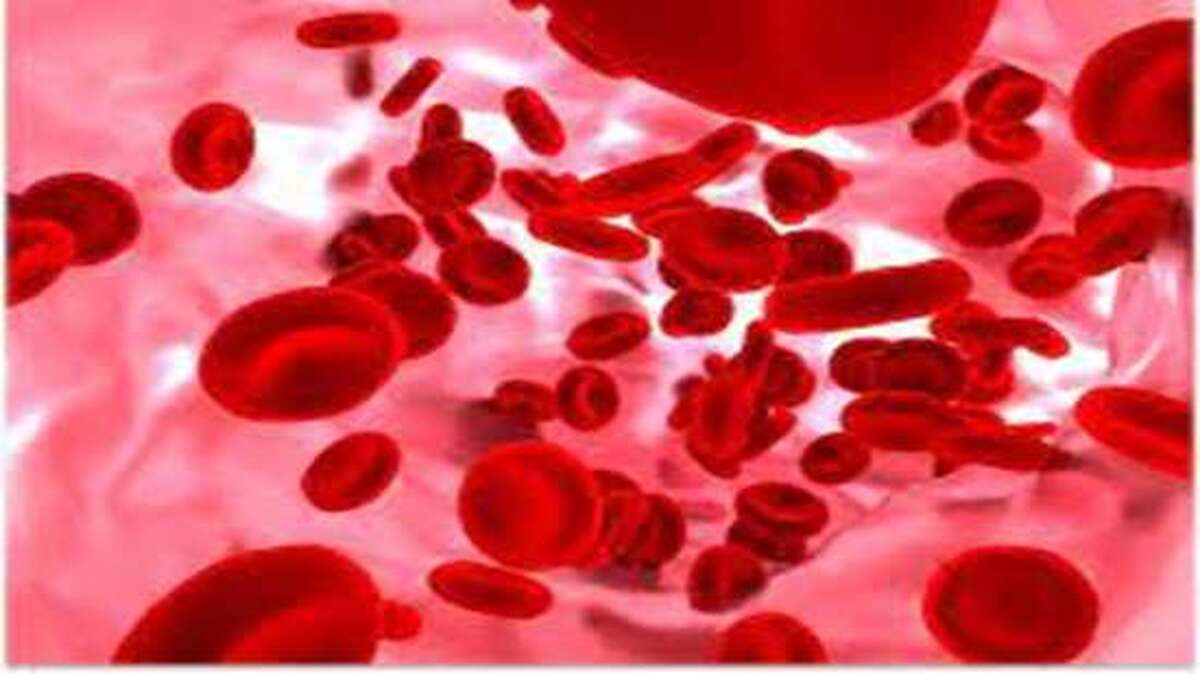 پیشگیری، ساده‌ترین راه مقابله با تالاسمی ماژور است