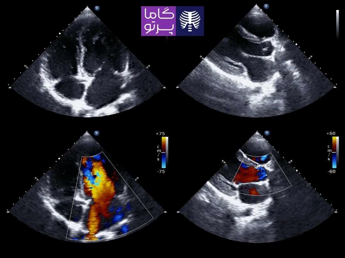 چربی‌های خوب، سپر نامرئی قلب شما (طبق راهنمای هاروارد)